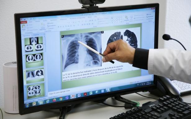 Preocupan secuelas en vías respiratorias