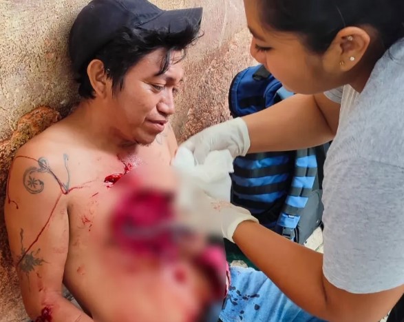 ¡¿Qué pasó compadre?! Pelea de borrachos termina en apuñalamiento en Chetumal